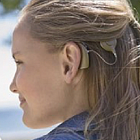 cochlear implant