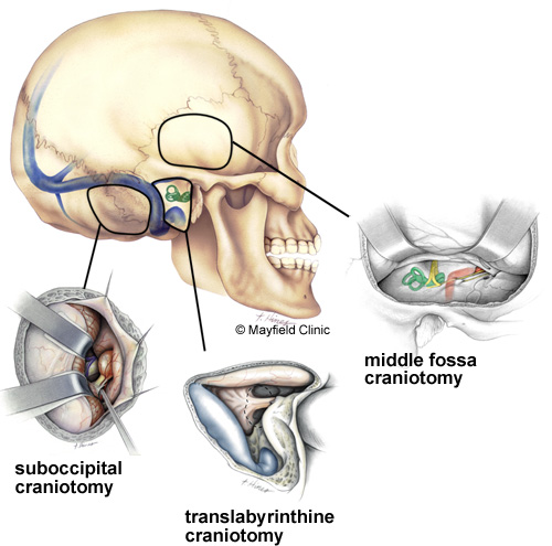 Surgical Approaches